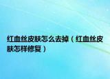 红血丝皮肤怎么去掉（红血丝皮肤怎样修复）