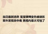 当日最新消息 宝宝银镯变色被送医意外发现汞中毒 真相内幕太可怕了
