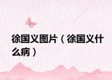 徐国义图片（徐国义什么病）
