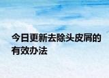 今日更新去除头皮屑的有效办法