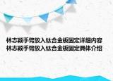 林志颖手臂放入钛合金板固定详细内容 林志颖手臂放入钛合金板固定具体介绍