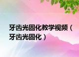 牙齿光固化教学视频（牙齿光固化）