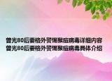 曾光80后要格外警惕猴痘病毒详细内容 曾光80后要格外警惕猴痘病毒具体介绍