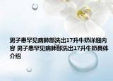 男子患罕见病肺部洗出17升牛奶详细内容 男子患罕见病肺部洗出17升牛奶具体介绍
