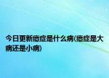 今日更新癔症是什么病(癔症是大病还是小病)