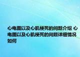 心电图以及心肌梗死的问题介绍 心电图以及心肌梗死的问题详细情况如何