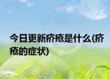 今日更新疥疮是什么(疥疮的症状)