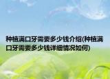 种植满口牙需要多少钱介绍(种植满口牙需要多少钱详细情况如何)