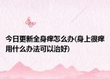今日更新全身痒怎么办(身上很痒用什么办法可以治好)