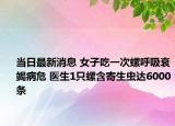 当日最新消息 女子吃一次螺呼吸衰竭病危 医生1只螺含寄生虫达6000条