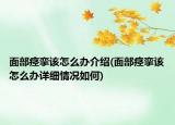 面部痉挛该怎么办介绍(面部痉挛该怎么办详细情况如何)