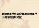 眨眼睛是什么病介绍(眨眼睛是什么病详细情况如何)