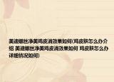 美迪娜丝净美鸡皮消效果如何(鸡皮肤怎么办介绍 美迪娜丝净美鸡皮消效果如何 鸡皮肤怎么办详细情况如何)