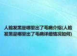 人脸发黑是哪里出了毛病介绍(人脸发黑是哪里出了毛病详细情况如何)