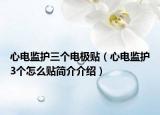 心电监护三个电极贴（心电监护3个怎么贴简介介绍）