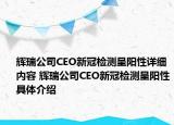 辉瑞公司CEO新冠检测呈阳性详细内容 辉瑞公司CEO新冠检测呈阳性具体介绍