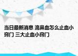 当日最新消息 流鼻血怎么止血小窍门 三大止血小窍门