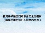 腋臭手术后伤口不愈合怎么办图片（腋臭手术后伤口不愈合怎么办）
