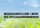 腰间盘突出酸胀怎么回事（腰间盘突出 为什么会出现酸麻胀痛等症状）