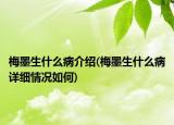 梅墨生什么病介绍(梅墨生什么病详细情况如何)