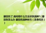 脚扭伤了,请问用什么方法尽快消肿?（脚扭伤怎么办 脚扭伤消肿妙方（亲身经历））