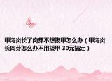甲沟炎长了肉芽不想拔甲怎么办（甲沟炎长肉芽怎么办不用拔甲 30元搞定）