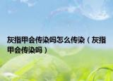 灰指甲会传染吗怎么传染（灰指甲会传染吗）
