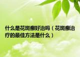什么是花斑癣好治吗（花斑癣治疗的最佳方法是什么）