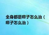全身都是痱子怎么治（痱子怎么治）