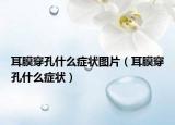 耳膜穿孔什么症状图片（耳膜穿孔什么症状）