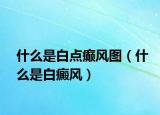 什么是白点癫风图（什么是白癜风）