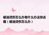 被油烫伤怎么办有什么办法快去痛（被油烫伤怎么办）
