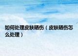 如何处理皮肤晒伤（皮肤晒伤怎么处理）