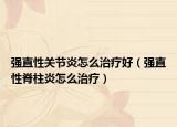 强直性关节炎怎么治疗好（强直性脊柱炎怎么治疗）