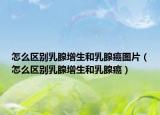 怎么区别乳腺增生和乳腺癌图片（怎么区别乳腺增生和乳腺癌）