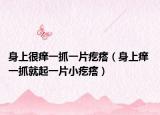 身上很痒一抓一片疙瘩（身上痒 一抓就起一片小疙瘩）