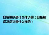 白色糠疹是什么样子的（白色糠疹及症状是什么样的）