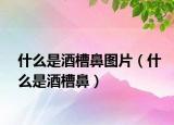 什么是酒槽鼻图片（什么是酒槽鼻）