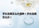 手长冻疮怎么办很肿（手长冻疮怎么办）