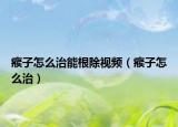 瘊子怎么治能根除视频（瘊子怎么治）