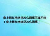 身上起红疙瘩是怎么回事不痛不痒（身上起红疙瘩是怎么回事）