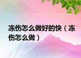 冻伤怎么做好的快（冻伤怎么做）