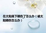 在太阳底下晒伤了怎么办（被太阳晒伤怎么办）