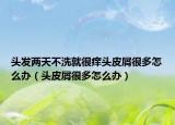 头发两天不洗就很痒头皮屑很多怎么办（头皮屑很多怎么办）