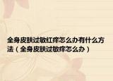 全身皮肤过敏红痒怎么办有什么方法（全身皮肤过敏痒怎么办）