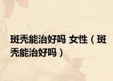 斑秃能治好吗 女性（斑秃能治好吗）