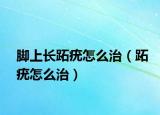 脚上长跖疣怎么治（跖疣怎么治）