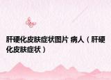 肝硬化皮肤症状图片 病人（肝硬化皮肤症状）