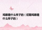 鸡眼是什么样子的（初期鸡眼是什么样子的）