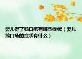 婴儿得了鹅口疮有哪些症状（婴儿鹅口疮的症状有什么）